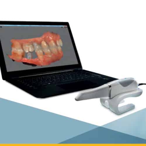 Laptop With Teeth Diagram — Pain Free Dental Clinic In Moss Vale, NSW