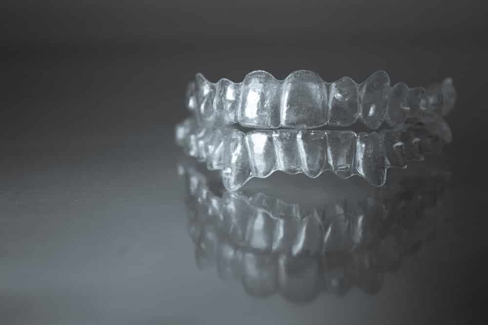A Clear Aligner