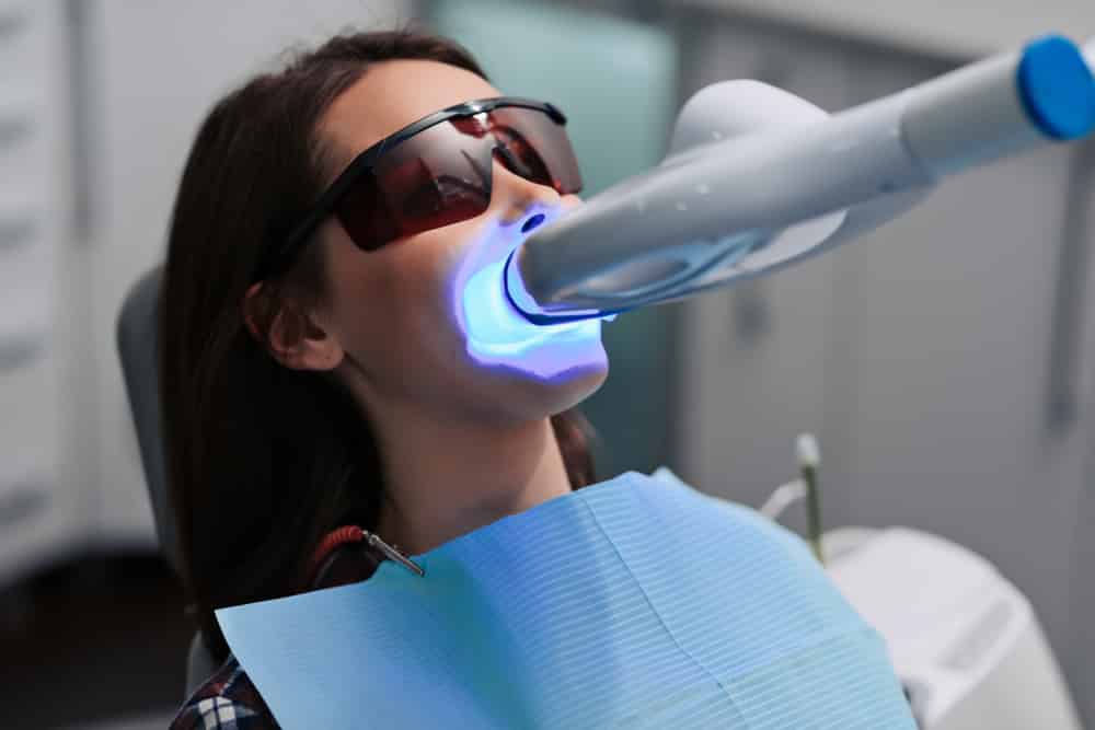 Teeth Whitening In Process — Pain Free Dental Clinic In Moss Vale, NSW