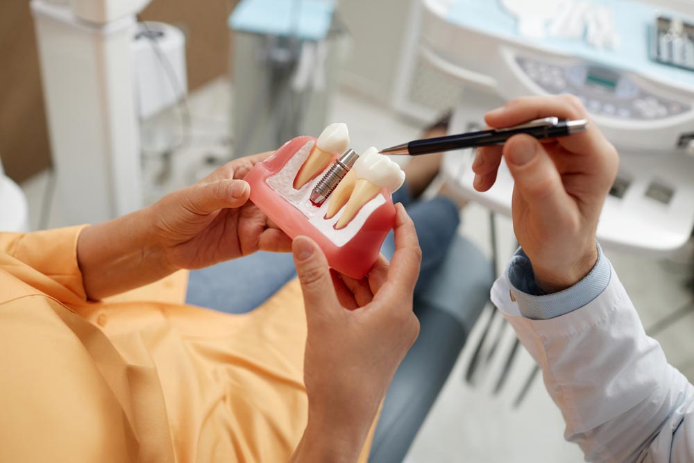 Dentist Explaining Dental Implant Procedure