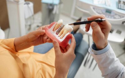 Dental Implant Surgery: Tips For Maintaining Oral Health