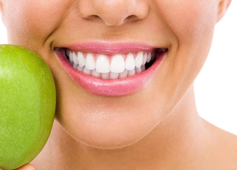 Teeth Whitening   Southern Highlands
